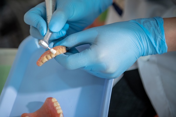 How Long Denture Repair May Take