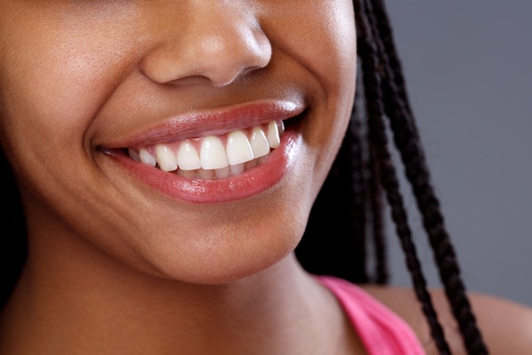 Life After A Smile Makeover: How To Protect Your Investment